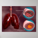 Search for bacterium posters Medicine