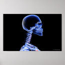 Search for x ray bones posters Human
