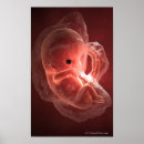 Search for development posters People