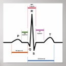 Search for ecg posters Electrocardiogram