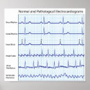 Search for pathological posters Human