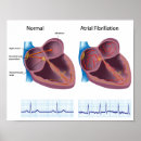 Search for fibril Cardiologist