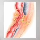 Search for bacterium posters Yellow