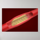 Search for blood vessels posters Artery