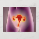 Search for uterus postcards Internal organs