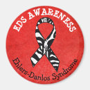 Search for eds magnets Syndrome
