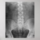 Search for orthopaedic posters Chiropractic