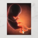Search for foetus postcards Medical