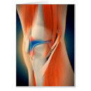 Search for inflammation Illustration