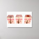 Search for causes art Human