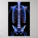 Search for x ray bones posters Rear view