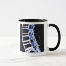 Search for vertebra mugs Medical