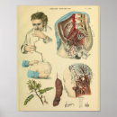 Search for surgery art Vintage