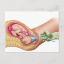 Search for childbirth postcards Development