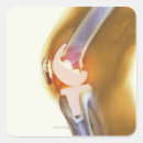 Search for body image stickers X ray image