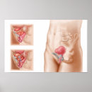Search for procedures posters Healthcare