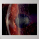 Search for eyesight posters Ophthalmologist
