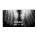 Search for x ray bones Medical
