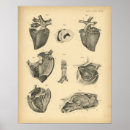 Search for atrium Ventricle