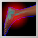 Search for ankles posters Foot