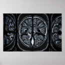 Search for neuroscience posters Anatomy