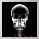 Search for x ray skeleton posters Gifts