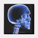 Search for human head magnets Part