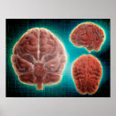 Search for neuroanatomy art Neurology