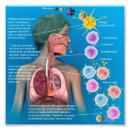 Search for allergic art Allergy