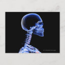 Search for x rays postcards Body
