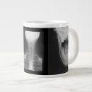 Search for x ray mugs Medical