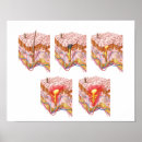 Search for corpuscle Close up