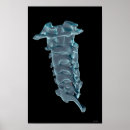 Search for cervical posters Medical