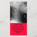 Search for xray cards Bones