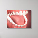 Search for gum canvas prints Orthodontics
