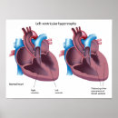 Search for blood chart posters Cardiologist