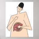 Search for liver posters Disease