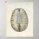 Search for neurology art Anatomy