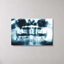 Search for dental canvas prints Mouth
