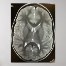 Search for mri magnets Scan