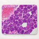 Search for histology Pathology