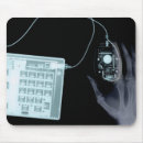 Search for xray electronics Skeleton