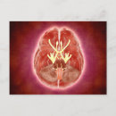 Search for nerves postcards Digitally generated image