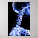 Search for x ray bones posters People