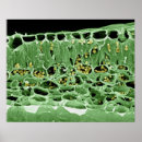 Search for electron micrography posters False colour
