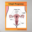 Search for pregnancy posters Health