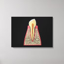 Search for gum canvas prints Teeth