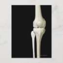 Search for knee postcards Medical
