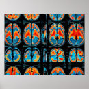 Search for radiology posters Medicine