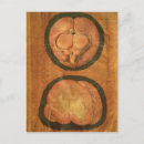 Search for anatomically postcards Fabricius